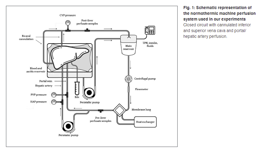 Schematic representation of the normothermic machine perfusion system used in our experiments